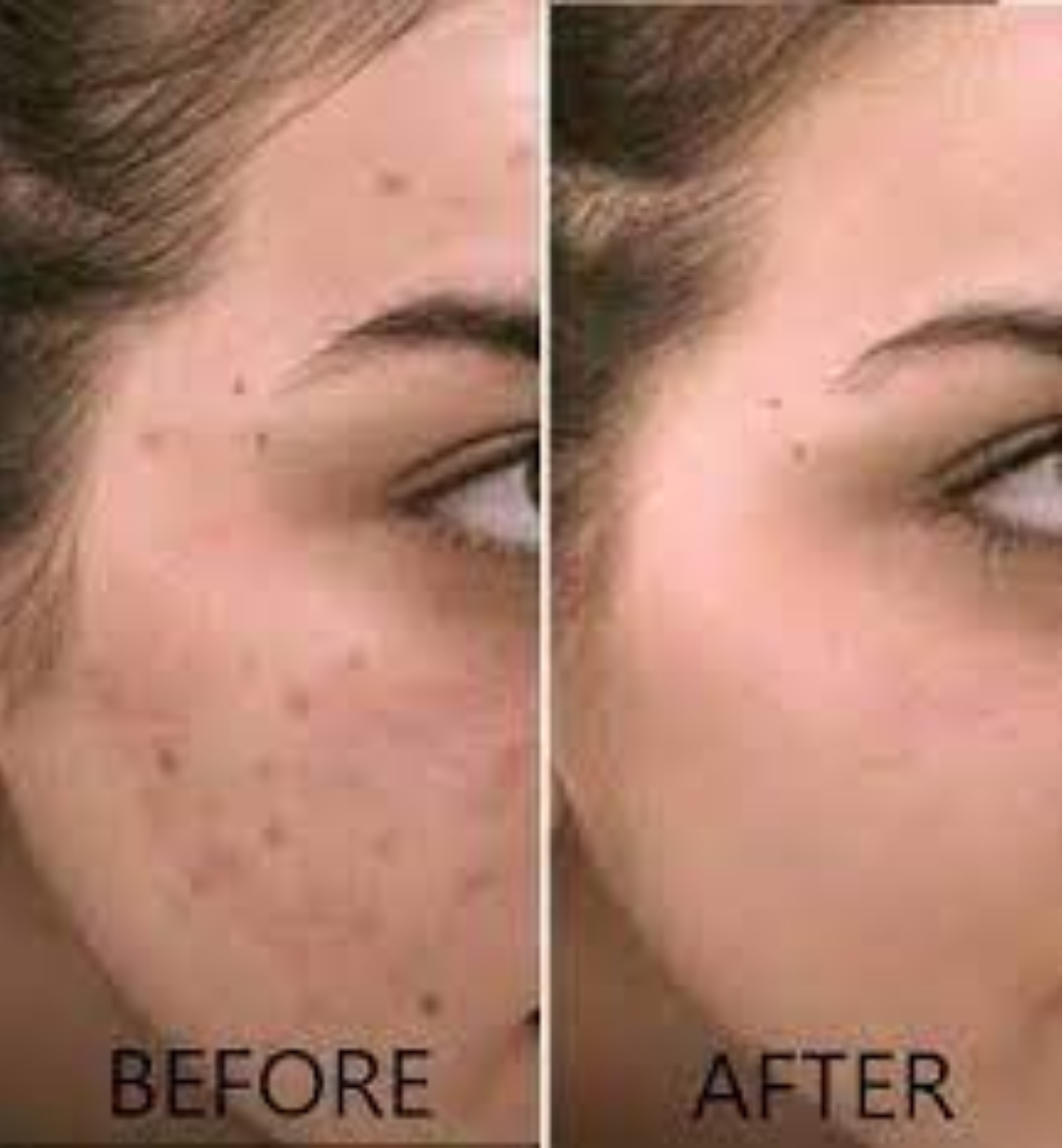 10% Vitamin C Face Serum with Hyaluronic Acid  30ml